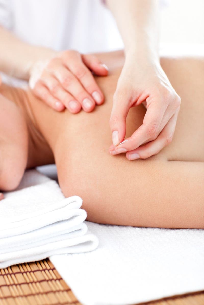 An acupuncturist's hands inserting a fine needle into a patient's upper back